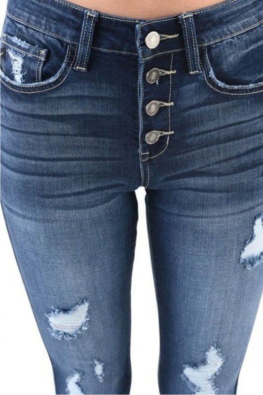 Hillary Button Fly Distressed Skinny Jeans